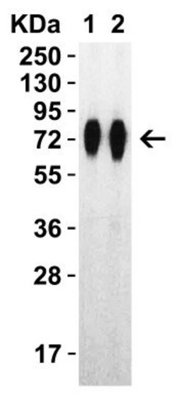 Novus Biologicals Recombinant SARS-CoV-2 Spike (RBD+SD1+SD2) His (C-Term) Protein 0.05 mg | Buy Online | Novus Biologicals&trade; | Fisher Scientific
